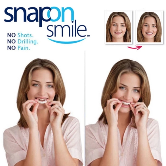 لمینت متحرک دندان تک فک Snap On Smile عکس محصول لمینت متحرک دندان تک فک Snap On Smile